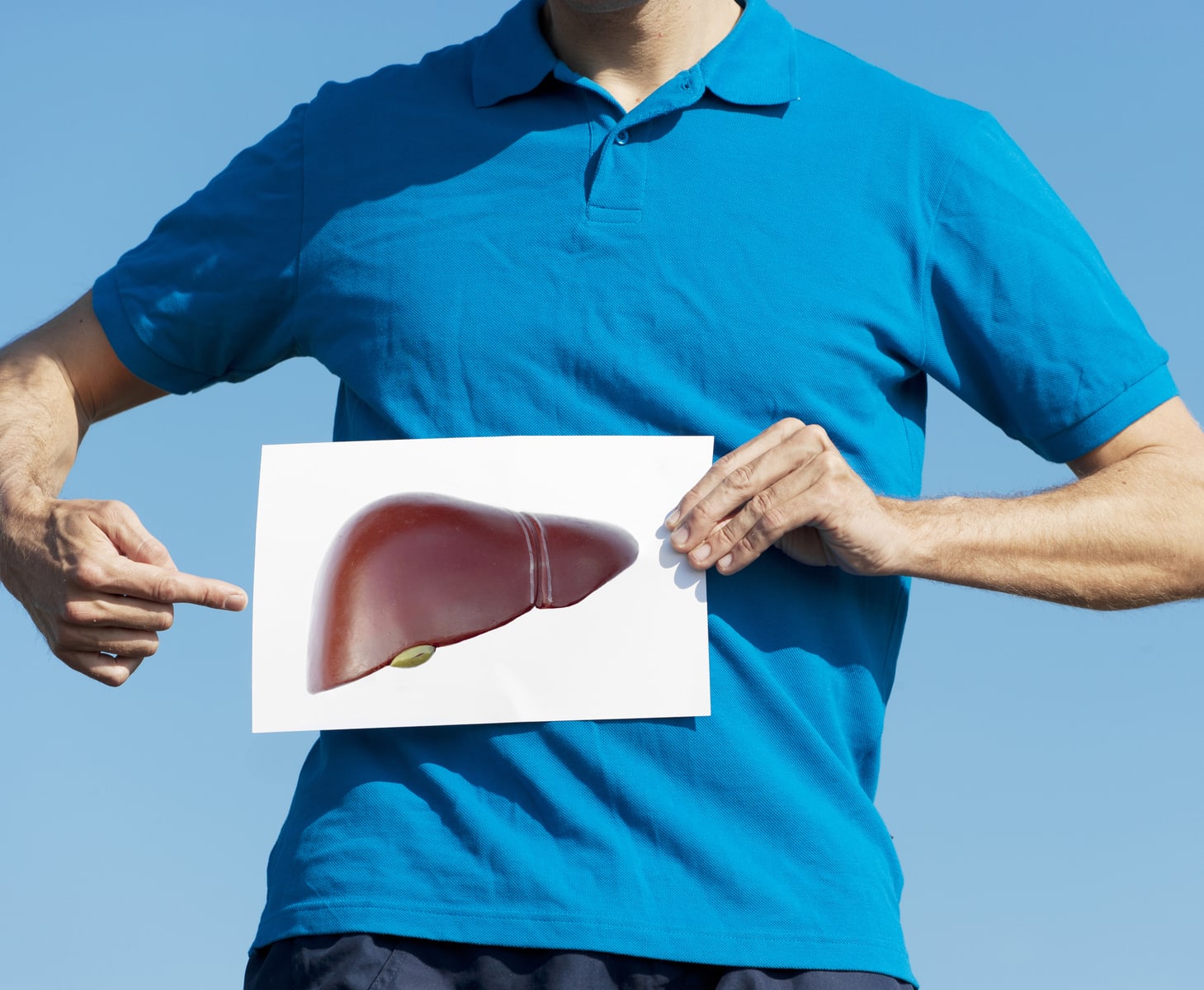 The-facts-on-fatty-liver-disease-iStock-174980367.jpg