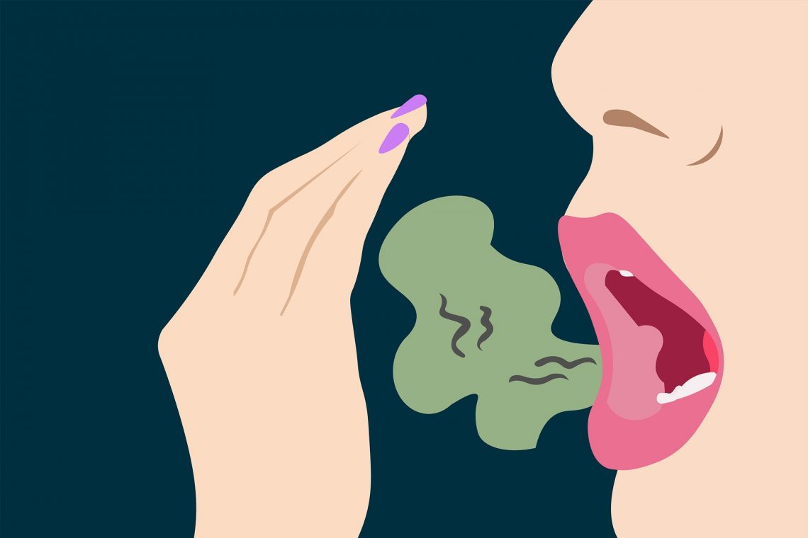 رائحة الفم الكريهة بسبب البكتيريا 