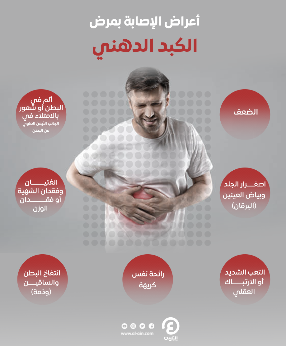 أعراض الكبد الدهني