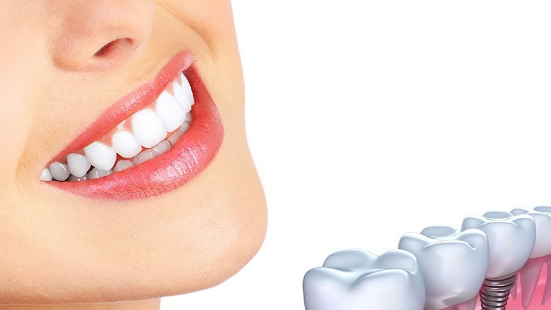المساعدة في تحسين صحة الأسنان