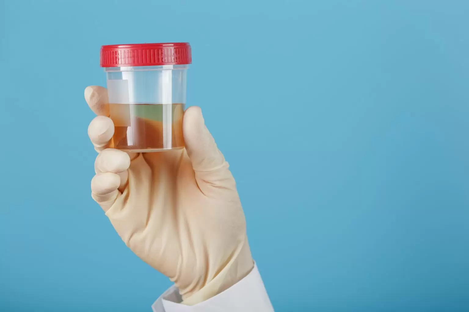 doctor-is-holding-plastic-can-urine-analysis-1536x1024-1.webp