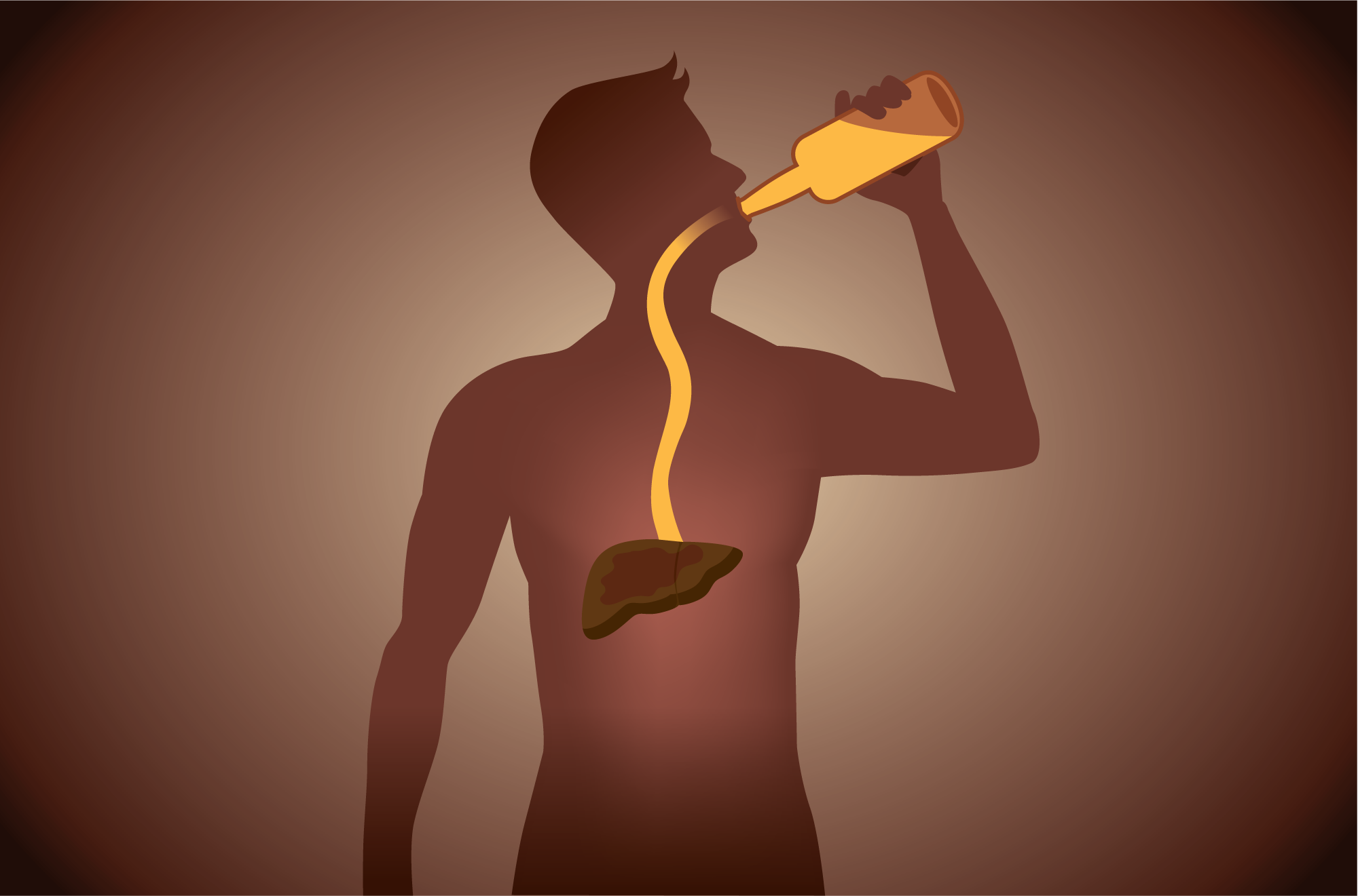 alcohol-liver-disease.png