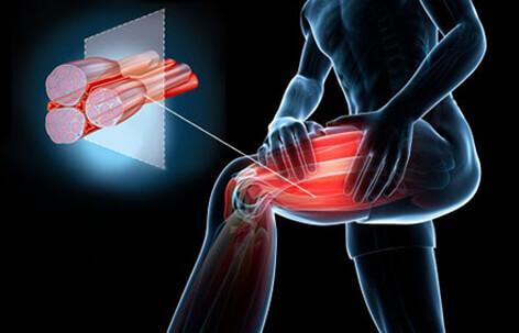 muscle-cramps-and-muscle-spasms-s3-signs-symptoms.jpg
