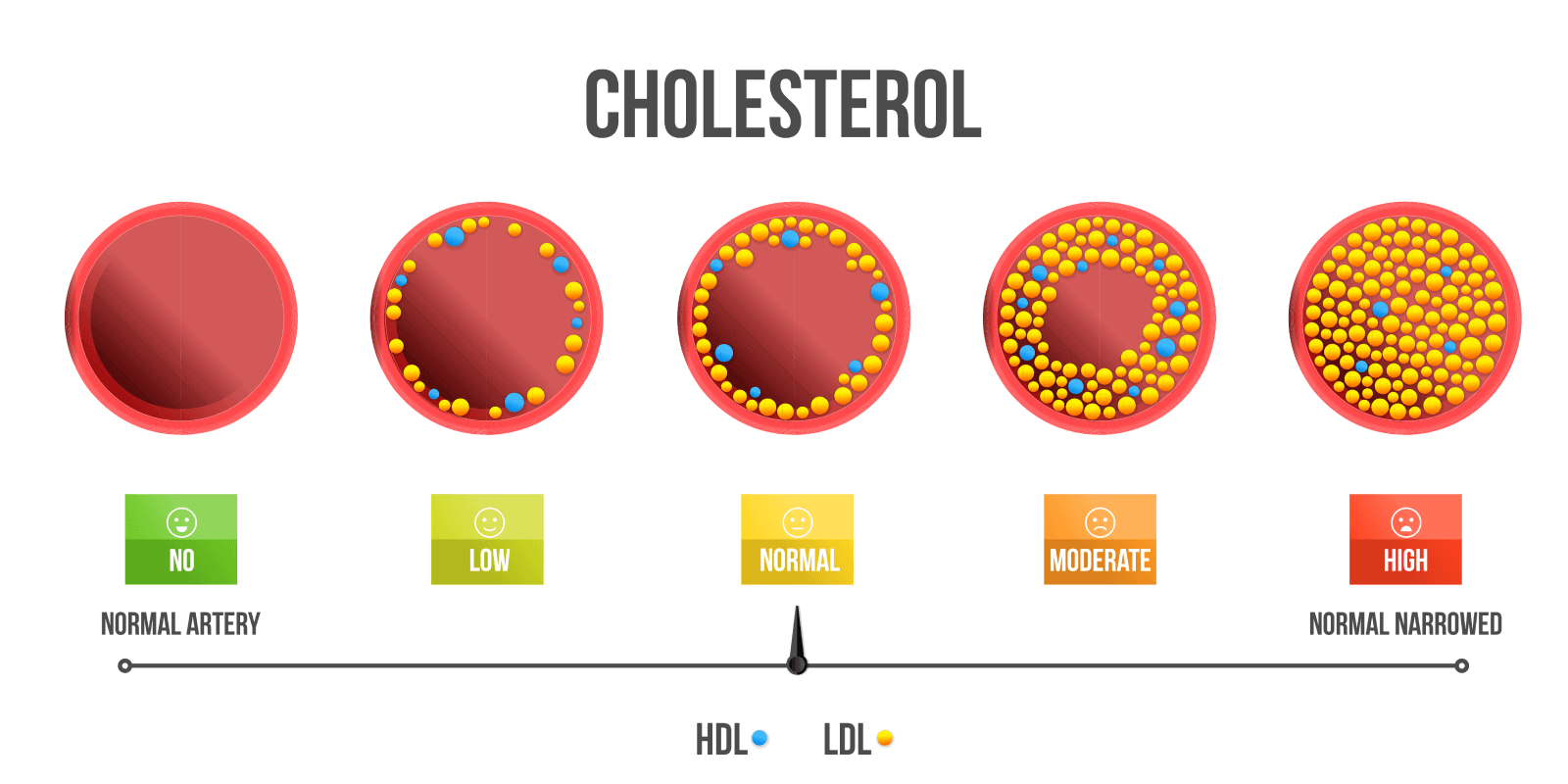 High_Cholesterol_e1bdccbdc9.png