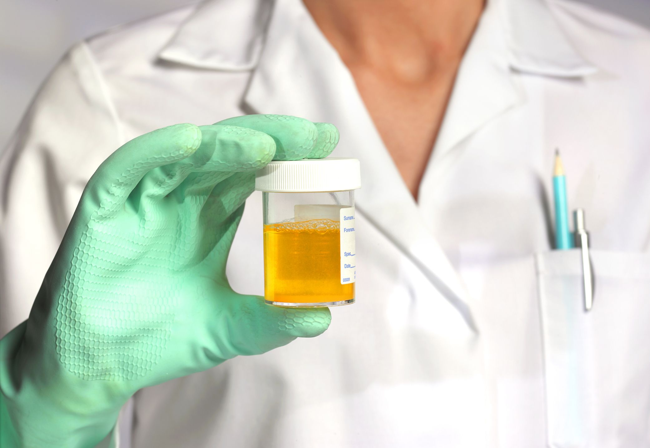 doctor-with-athlete-sportsmans-urine-sample-royalty-free-image-1712546181.jpg