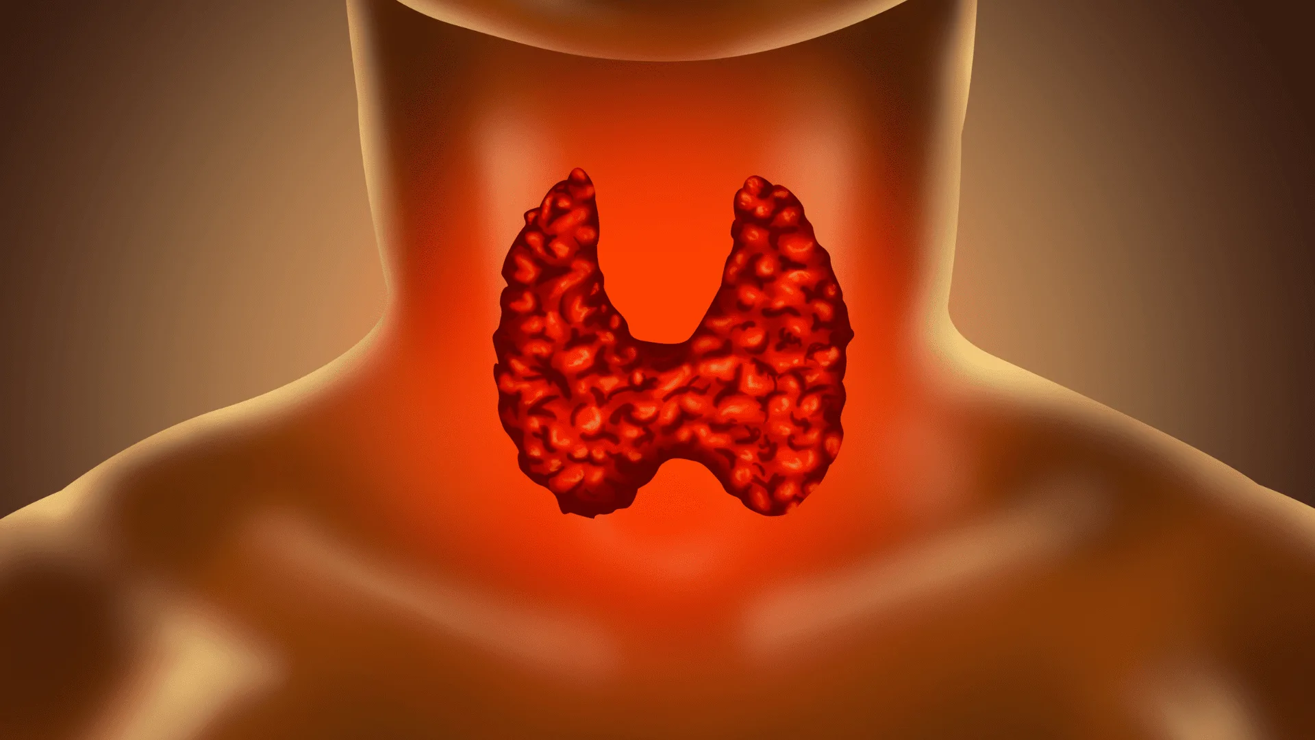 hypothyroidism.png.webp