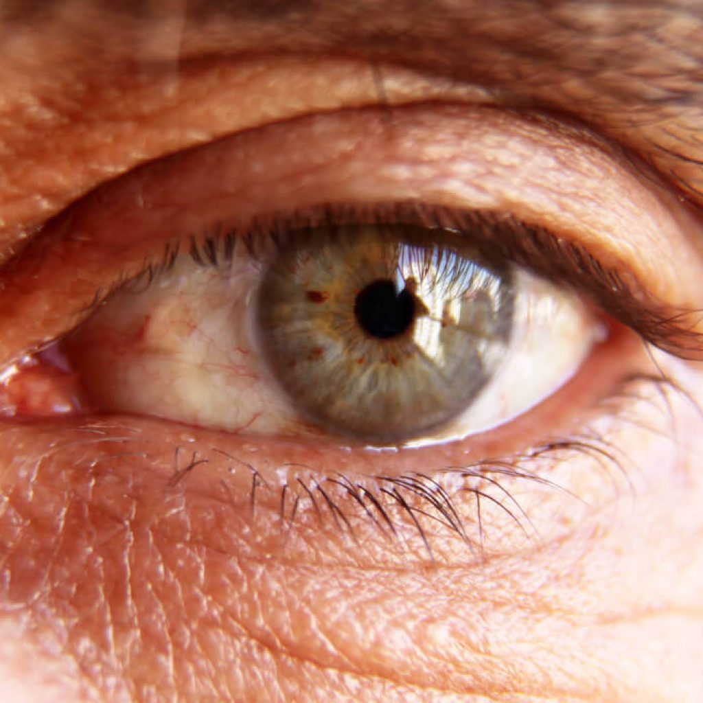 فقدان البصر لمريض السكري