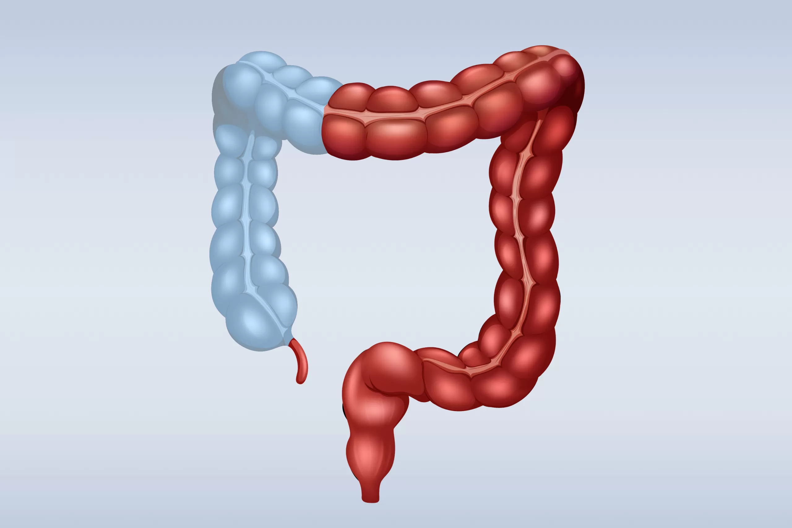 القولون التقرحي