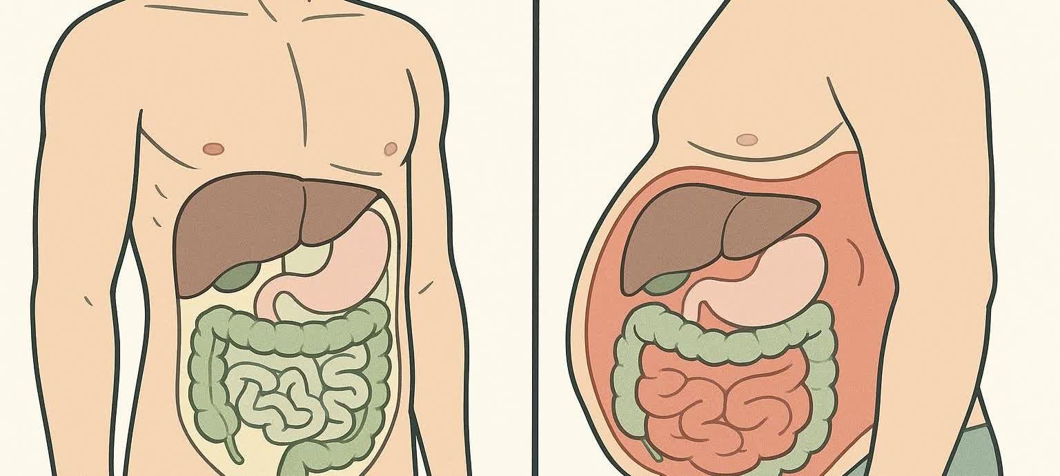 الدهون الحشوية