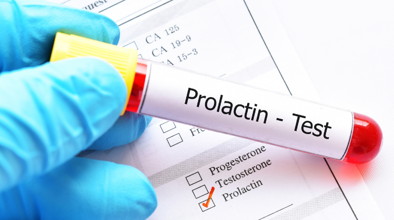 What-is-hyperprolactinaemia-770-x-430-400761004657234-824797.png