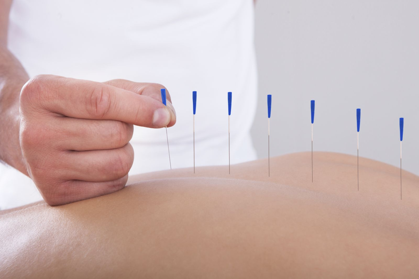 acupuncture-pain-relief-complementary.jpg