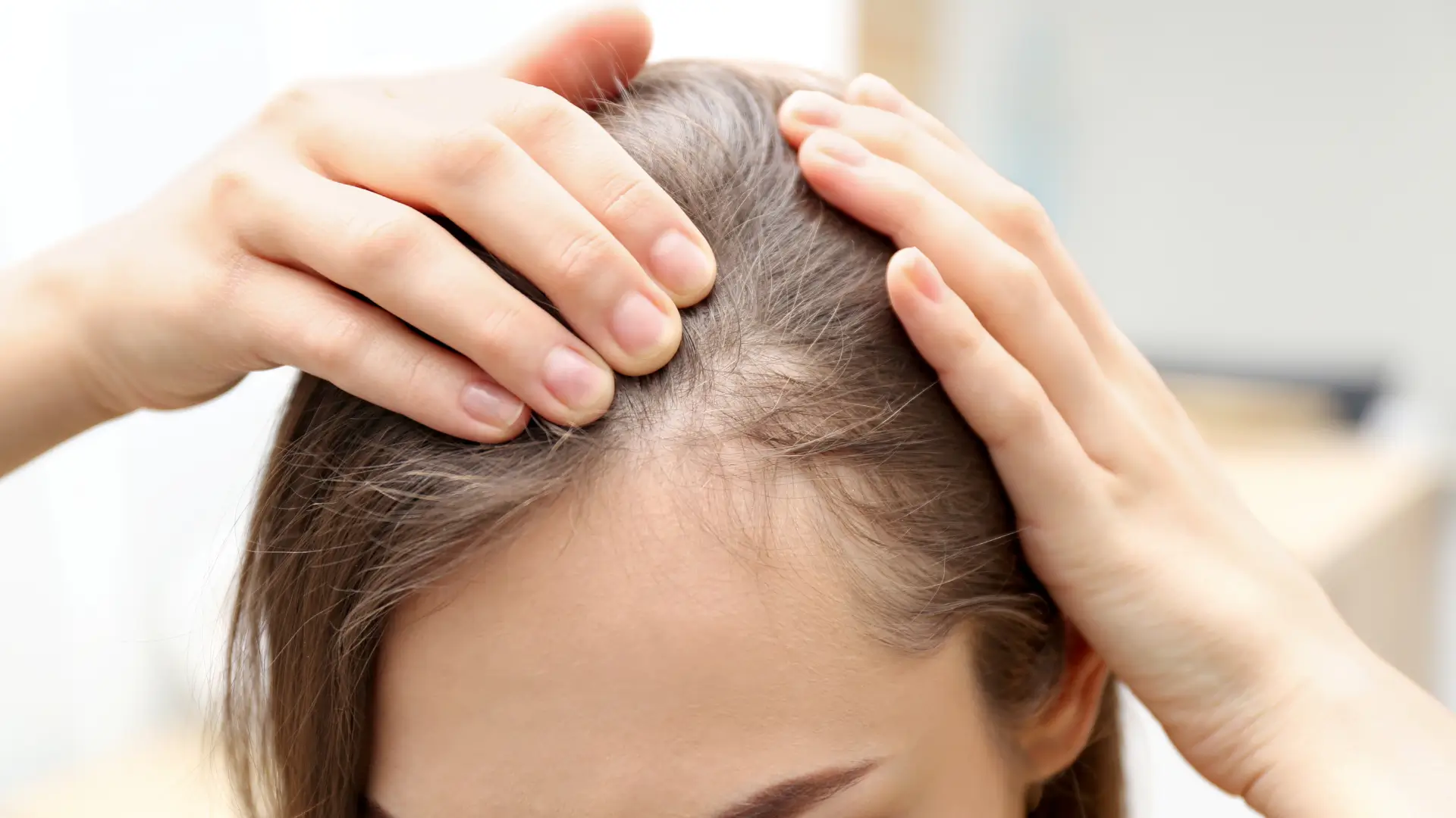 Does-Mounjaro-Cause-Hair-Loss.webp