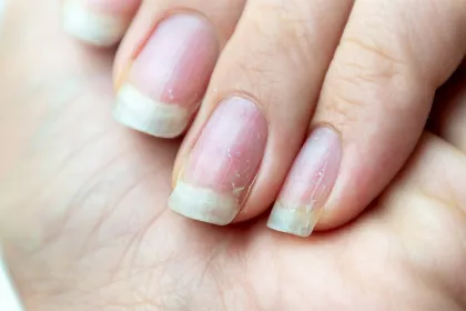 Brittle_Nails_1500x.webp