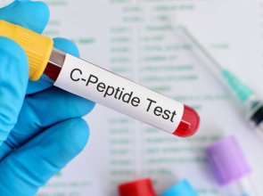 اختبار السي-ببتيد C-Peptide