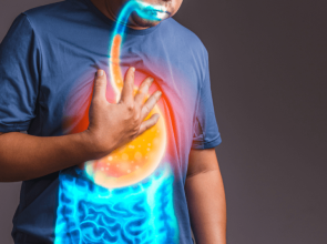 كيفية علاج آثار ارتجاع الحمض على حلقك