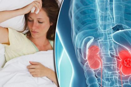 kidney4.jpg